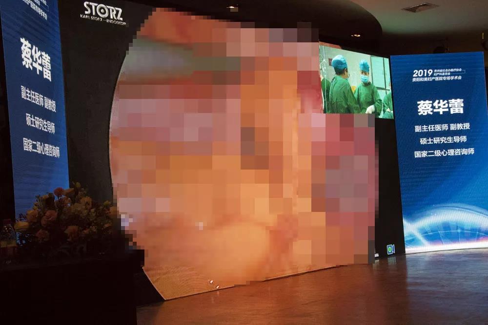手术演示1.jpg